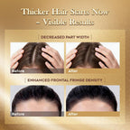 LUMÉI Rosemary Infused Hair Growth Support Serum Caffeine Glycerin Diaminopy-rimidine oxide Advanced Root Renewal Formula