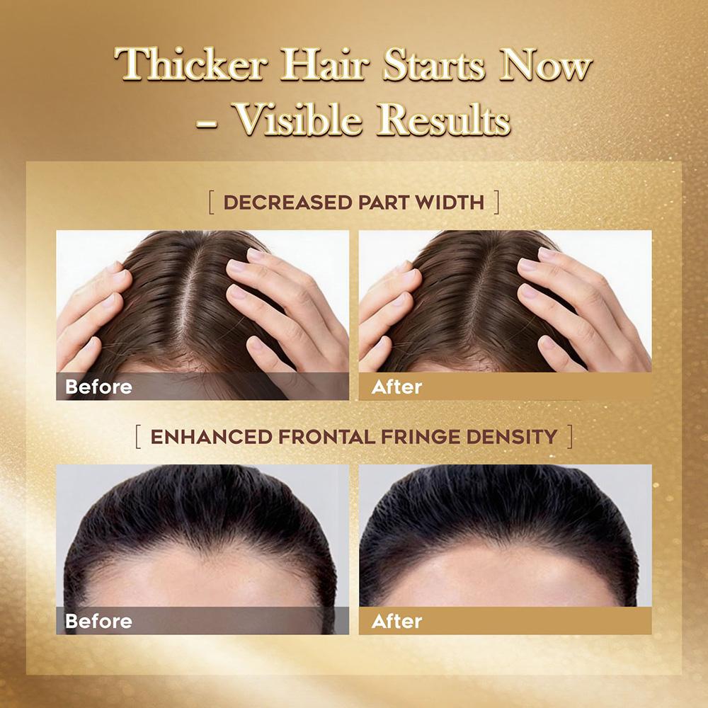 LUMÉI Rosemary Infused Hair Growth Support Serum Caffeine Glycerin Diaminopy-rimidine oxide Advanced Root Renewal Formula
