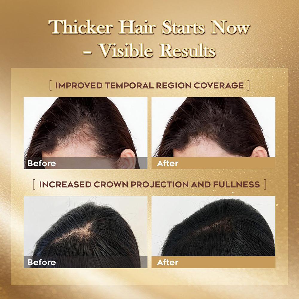 LUMÉI Rosemary Infused Hair Growth Support Serum Caffeine Glycerin Diaminopy-rimidine oxide Advanced Root Renewal Formula
