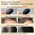 [FDA Approved] LUMÉI Biotin+Keratin Advanced Hair Booster Dietary Supplement Anti-Hair Loss Anti-Hair Thin 30 Capsules
